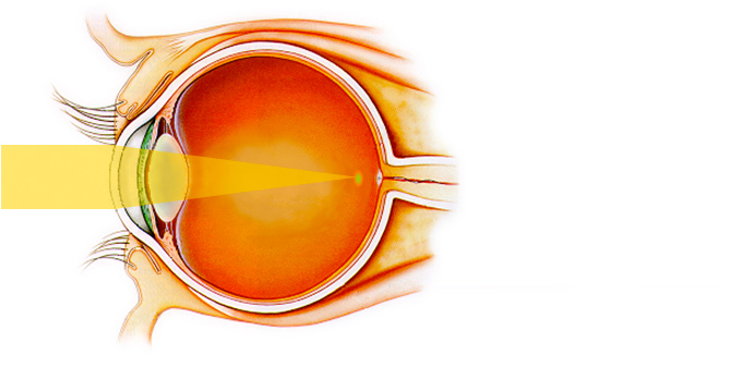 眼球剖面圖Internal Eye Anatomy